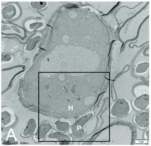 A microscope view of a cell

Description automatically generated